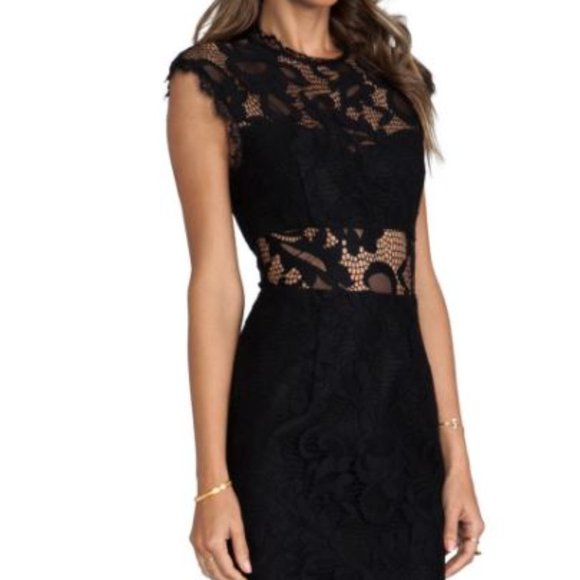Dolce Vita Iman Black Lace Dress XS - Picture 3 of 7